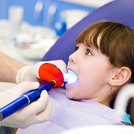 girl getting a filling with a curing light